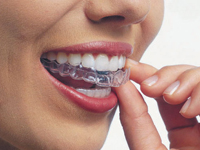 Invisible braces are available in Norwich